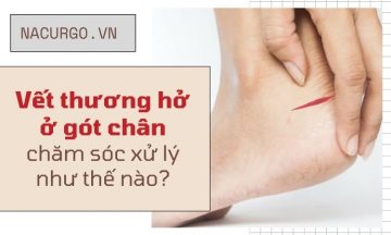 vet-thuong-ho-o-got-chan