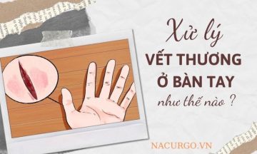 xu-ly-vet-thuong-ban-tay