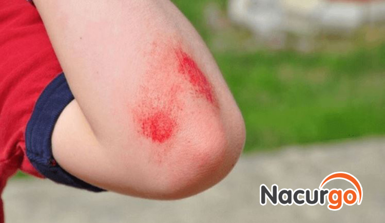 Đây là sản phẩm giúp vết thương được bảo vệ tối ưu, mau lành lại hơn