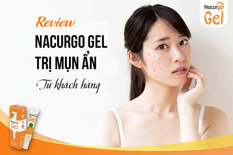 Re tri mụn ẩn